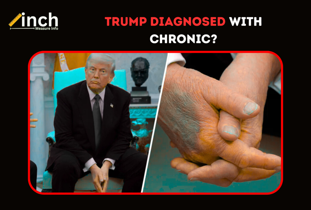 Trump Diagnosed With Chronic?